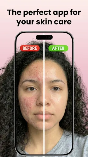 Skin Care Scanner: GlowUp screenshot