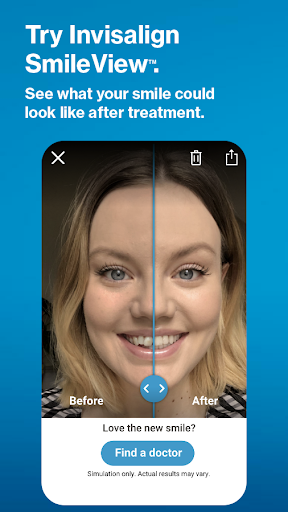 My Invisalign - Official App screenshot